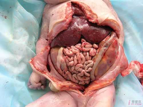 孕36周胎儿肠管扩张该怎么办,32周胎儿肠管扩张正常范围  第1张