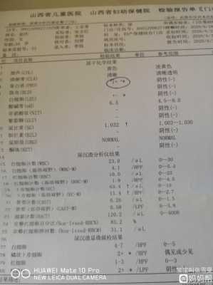 孕期尿蛋白(孕期尿蛋白1+正常吗) 第1张 孕期尿蛋白(孕期尿蛋白1+正常吗) 第1张