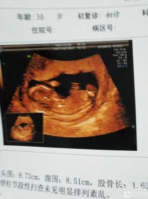 15周胎儿清晰大图（15周胎儿清晰大图男女）  第2张