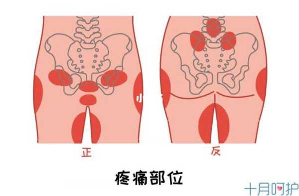 孕期屁股疼(孕妇臀部疼痛是怎么回事) 第3张 孕期屁股疼(孕妇臀部疼痛是怎么回事) 第3张