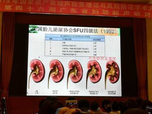 胎儿双肾肾盂分离怎么回事（腹中胎儿双肾肾盂分离怎么回事）  第1张