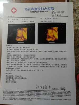 孕妇做彩超对胎儿有影响吗(怀孕彩超能检查出什么?一般怀孕多长时间可以做呢) 第2张 孕妇做彩超对胎儿有影响吗(怀孕彩超能检查出什么?一般怀孕多长时间可以做呢) 第2张