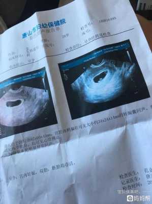 孕妇做彩超对胎儿有影响吗(怀孕彩超能检查出什么?一般怀孕多长时间可以做呢) 第3张 孕妇做彩超对胎儿有影响吗(怀孕彩超能检查出什么?一般怀孕多长时间可以做呢) 第3张