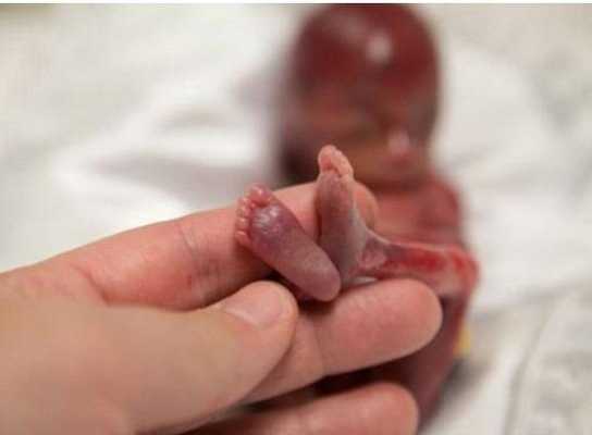 19周的胎宝宝有多少毫米,怀孕19周胎儿高清图片  第2张