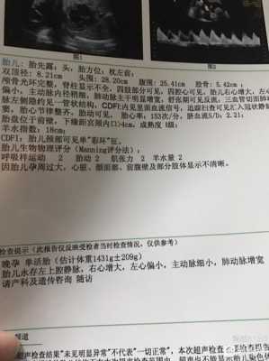 孕妇胆汁酸30严重吗,胆汁酸高到多少终止妊娠 第2张 孕妇胆汁酸30严重吗,胆汁酸高到多少终止妊娠 第2张