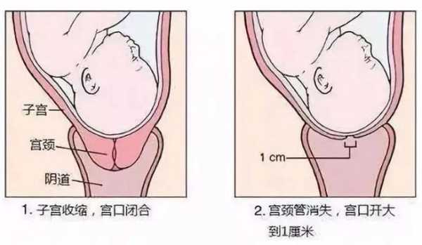 孕期宫颈长度（怀孕24周宫颈管多长是正常）  第2张