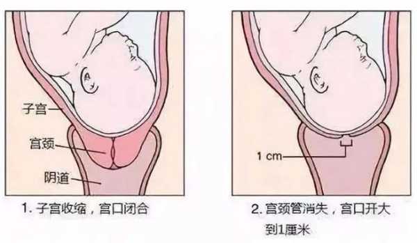 孕期宫颈长度(怀孕24周宫颈管多长是正常) 第2张 孕期宫颈长度(怀孕24周宫颈管多长是正常) 第2张