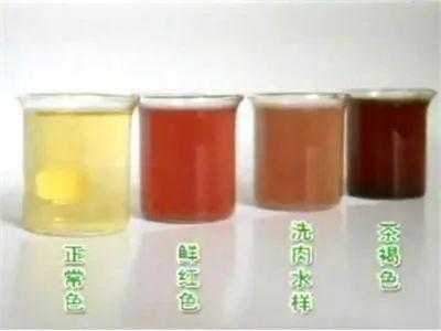 孕期血尿(孕期血尿) 第2张 孕期血尿(孕期血尿) 第2张