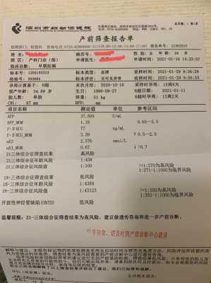 唐氏筛查是查什么,唐筛一般什么人过不了 第2张 唐氏筛查是查什么,唐筛一般什么人过不了 第2张