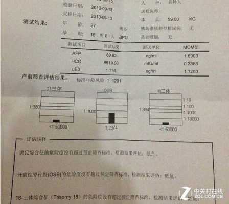 唐氏筛查是查什么,唐筛一般什么人过不了 第1张 唐氏筛查是查什么,唐筛一般什么人过不了 第1张