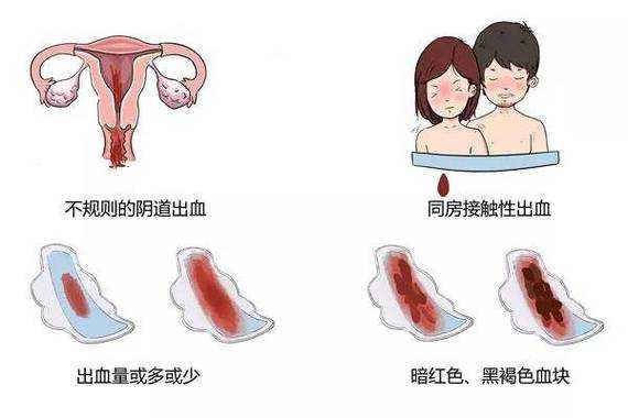 孕期阴道出血（孕期下面出血但不疼什么情况）  第2张