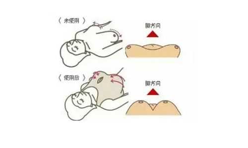 怀孕乳房下垂怎么纠正?方法是什么啊,孕期胸下垂正常吗 第1张 怀孕乳房下垂怎么纠正?方法是什么啊,孕期胸下垂正常吗 第1张
