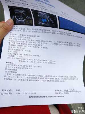 胎儿颈部见w型压迹怎么办好呢,胎儿颈部可见w型压迹什么意思,并见彩色血流信号环绕 第2张 胎儿颈部见w型压迹怎么办好呢,胎儿颈部可见w型压迹什么意思,并见彩色血流信号环绕 第2张