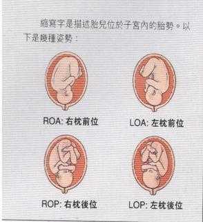 什么叫定胎位,  第2张