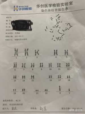 胎儿染色体异常(染色体异常的胎儿能要吗) 第2张 胎儿染色体异常(染色体异常的胎儿能要吗) 第2张