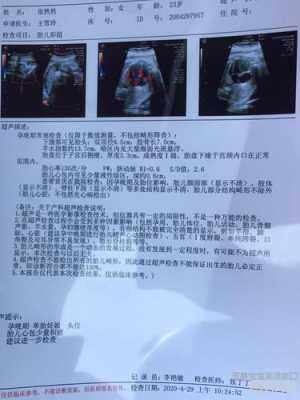 胎儿心包积液(胎儿心包积液正常范围) 第2张 胎儿心包积液(胎儿心包积液正常范围) 第2张