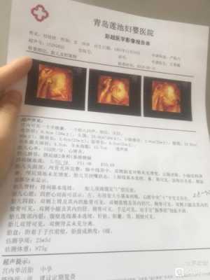 胎儿四维彩超图片(卸货的宝妈都来说说宝宝生下来和四维彩超照片像不像) 第3张 胎儿四维彩超图片(卸货的宝妈都来说说宝宝生下来和四维彩超照片像不像) 第3张