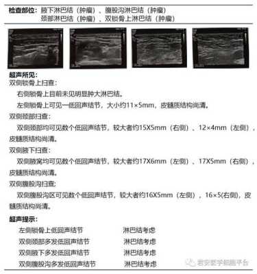 安全b证一年考几次,孕期b超做几次最好  第2张