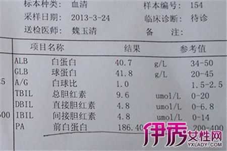孕期白蛋白低(孕期白蛋白低对胎儿有什么影响) 第2张 孕期白蛋白低(孕期白蛋白低对胎儿有什么影响) 第2张