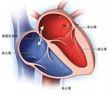 胎儿卵圆孔正常值（怀孕6个月卵圆孔0.55cm能自愈吗）  第3张