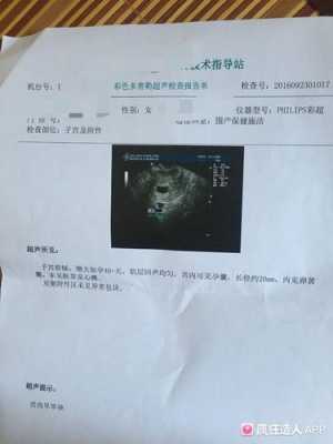 孕期孕酮降低(怀孕44天胎心胎芽都正常但是孕酮降低了怎么回事) 第1张 孕期孕酮降低(怀孕44天胎心胎芽都正常但是孕酮降低了怎么回事) 第1张