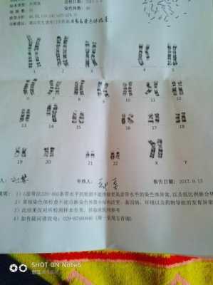 胎儿染色体异常能要吗(胎儿染色体异常能要吗) 第2张 胎儿染色体异常能要吗(胎儿染色体异常能要吗) 第2张