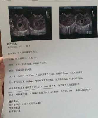 孕早期b超ut是什么？能看出什么呢,孕早期做b超对胎儿有影响吗 好大夫  第1张