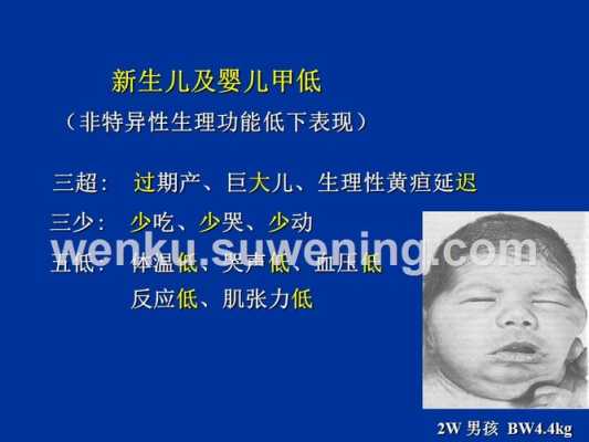 新生儿患先天性甲状腺低下症服药会和正常娃娃一样发育吗,孕妇甲减会影响胎儿发育吗 第1张 新生儿患先天性甲状腺低下症服药会和正常娃娃一样发育吗,孕妇甲减会影响胎儿发育吗 第1张