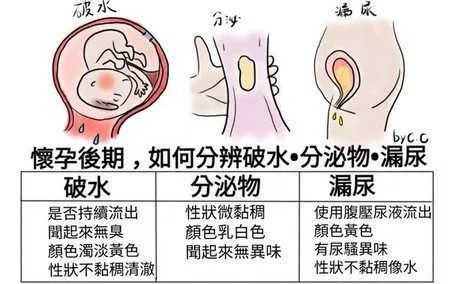 孕期分泌物多怎么办(孕晚期分泌物增多怎么回事) 第2张 孕期分泌物多怎么办(孕晚期分泌物增多怎么回事) 第2张