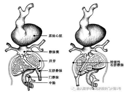 胎儿右脐静脉什么意思（胎儿右脐静脉可能什么意思）  第2张