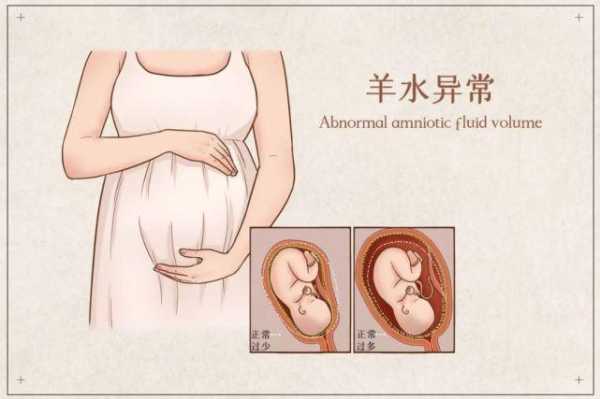 孕期羊水多怎么办(孕晚期羊水多怎么办) 第2张 孕期羊水多怎么办(孕晚期羊水多怎么办) 第2张