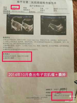 孕期卵巢囊肿怎么办,孕期卵巢囊肿怎么办才好 第2张 孕期卵巢囊肿怎么办,孕期卵巢囊肿怎么办才好 第2张
