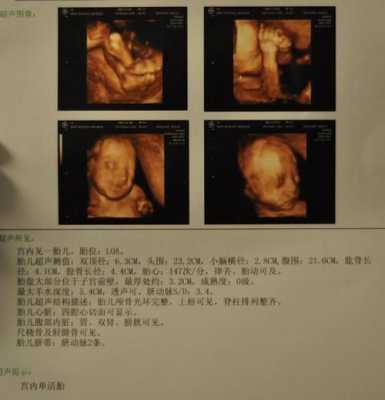 孕35周，孩子都六斤多了，应该怎么控制,6周大的胎儿图片b超图  第1张