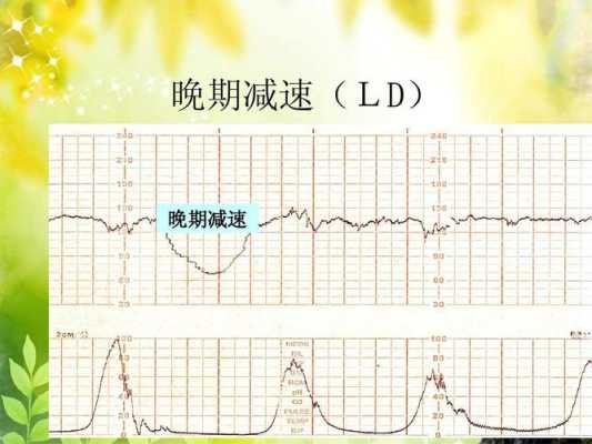 胎心监护胎心过高160—190对胎儿的影响有多大,胎心率160到170正常吗 第2张 胎心监护胎心过高160—190对胎儿的影响有多大,胎心率160到170正常吗 第2张