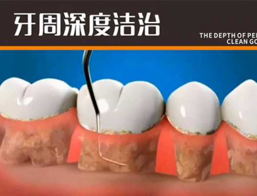 孕妇牙齿松动怎么办?孕妇牙齿松是怎么回事,孕期牙齿松动怎么办可以拔掉吗 第1张 孕妇牙齿松动怎么办?孕妇牙齿松是怎么回事,孕期牙齿松动怎么办可以拔掉吗 第1张