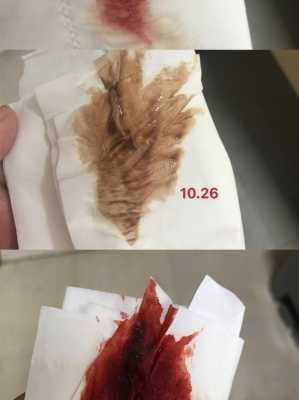 怀孕初期出血多久会好,怀孕期间流血了怎么回事 第2张 怀孕初期出血多久会好,怀孕期间流血了怎么回事 第2张