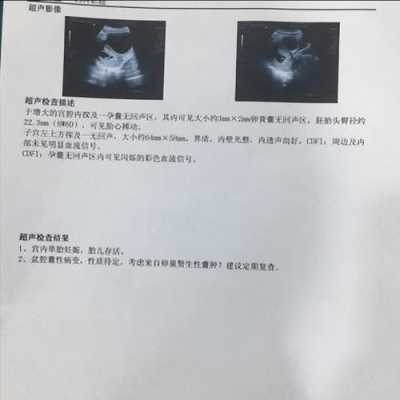 彩超做多了对胎儿有影响吗(b超体检多久做一次?做多了有什么坏处) 第1张 彩超做多了对胎儿有影响吗(b超体检多久做一次?做多了有什么坏处) 第1张