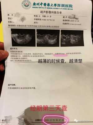 彩超做多了对胎儿有影响吗(b超体检多久做一次?做多了有什么坏处) 第2张 彩超做多了对胎儿有影响吗(b超体检多久做一次?做多了有什么坏处) 第2张