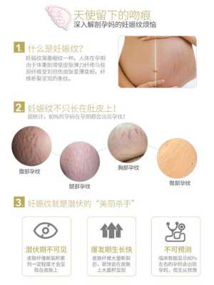 怀孕期间妊娠纹怎么消除,孕期妊娠纹怎么预防增生 第2张 怀孕期间妊娠纹怎么消除,孕期妊娠纹怎么预防增生 第2张