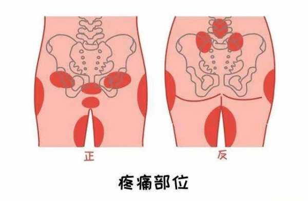 怀孕期间阴道疼（怀孕期间为什么下面会疼）  第1张