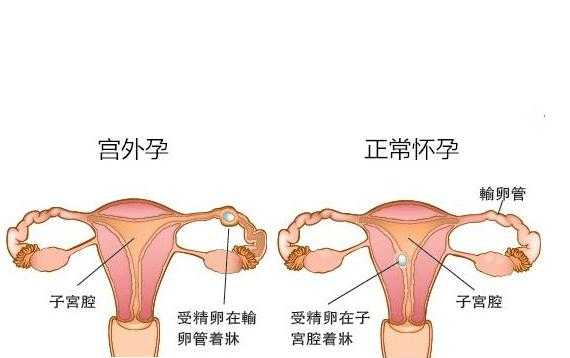 孕期小肚子隐隐作痛（孕期小肚子隐隐作痛正常吗）  第2张