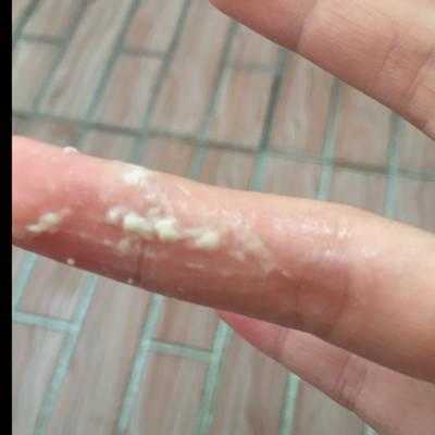 孕期阴部痒怎么办,孕期下体痒怎么办有豆腐渣 第2张 孕期阴部痒怎么办,孕期下体痒怎么办有豆腐渣 第2张