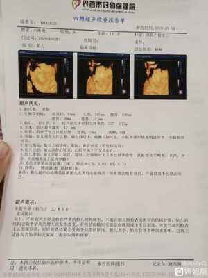 孕期四维查什么(孕期检查四维是查什么) 第2张 孕期四维查什么(孕期检查四维是查什么) 第2张