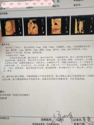 孕期四维查什么(孕期检查四维是查什么) 第3张 孕期四维查什么(孕期检查四维是查什么) 第3张