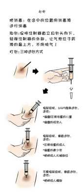 孕期打肝素的作用(备孕打肝素的作用是什么) 第1张 孕期打肝素的作用(备孕打肝素的作用是什么) 第1张