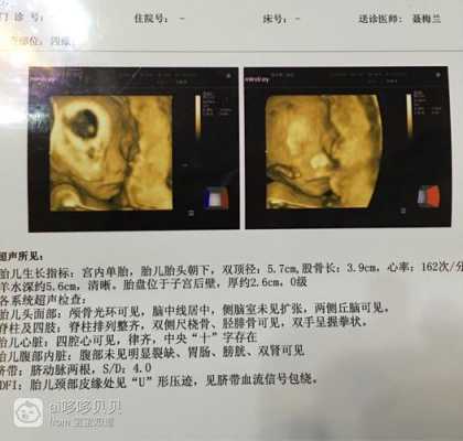 23周男女胎儿区别图(23周的三维宝宝的数据都在正常指标吗?需要注意什么) 第2张 23周男女胎儿区别图(23周的三维宝宝的数据都在正常指标吗?需要注意什么) 第2张