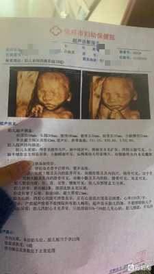 23周男女胎儿区别图(23周的三维宝宝的数据都在正常指标吗?需要注意什么) 第1张 23周男女胎儿区别图(23周的三维宝宝的数据都在正常指标吗?需要注意什么) 第1张