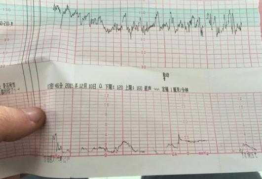 孕妇做胎心监护时,宝宝心率很高是怎么回事,孕晚期胎儿心率快是怎么回事 第2张 孕妇做胎心监护时,宝宝心率很高是怎么回事,孕晚期胎儿心率快是怎么回事 第2张