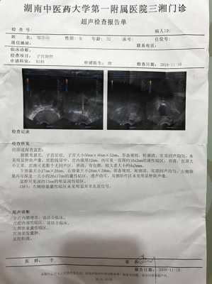 怀孕三个月咳嗽对胎儿有影响吗（怀孕三个月咳嗽怎么治最有效）  第2张