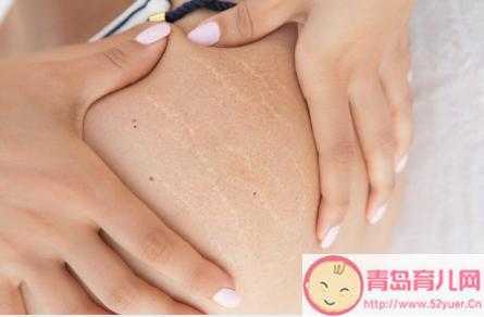 孕期肚脐周围发黑(生完宝宝后肚皮和肚脐都变黑了,该怎么办) 第2张 孕期肚脐周围发黑(生完宝宝后肚皮和肚脐都变黑了,该怎么办) 第2张